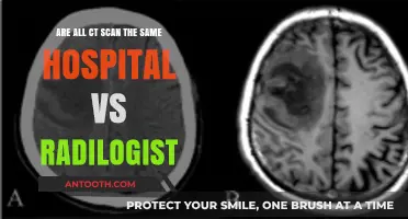 CT Scans: Hospital vs. Radiologist - Are They Really the Same?