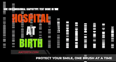 Chromosomal Karyotype Testing: Is It Routine at Birth in Hospitals?
