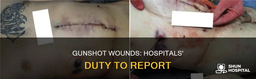 are hospitals required to report gunshot wounds
