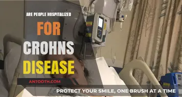 Understanding Crohn's Disease: Hospitalization and Management