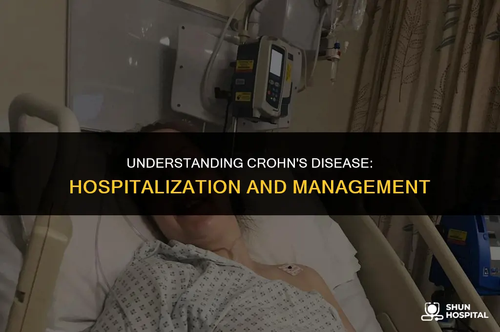 are people hospitalized for crohns disease