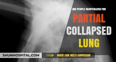 Partial Lung Collapse: When Hospitalization is Necessary