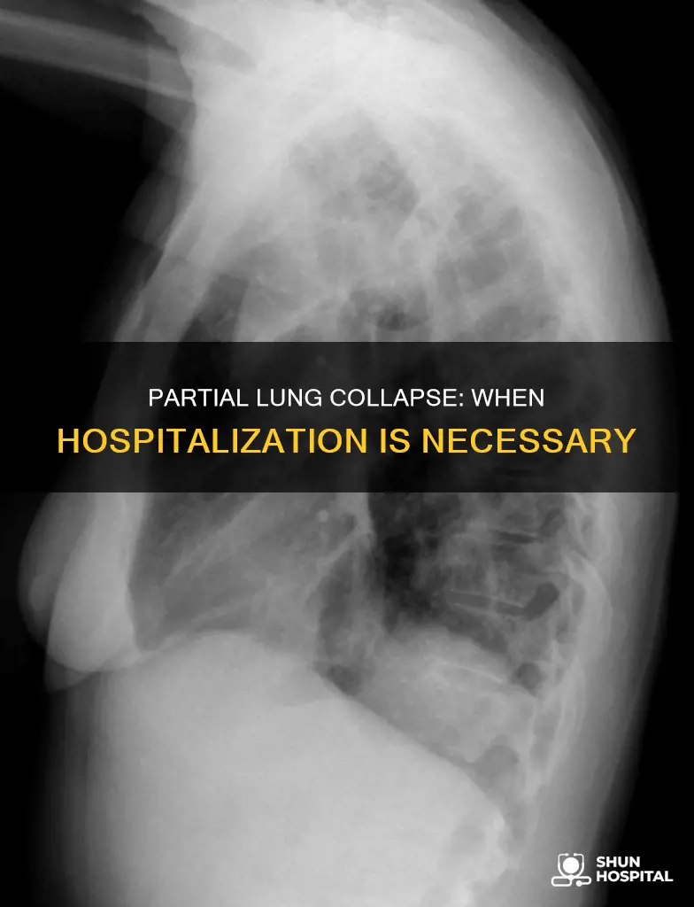 are people hospitalized for partial collapsed lung