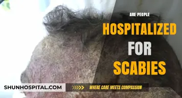 Are Scabies Hospitalizations Common? Understanding Severe Infestation Cases