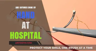 How Are Sutures Done in Hospitals?