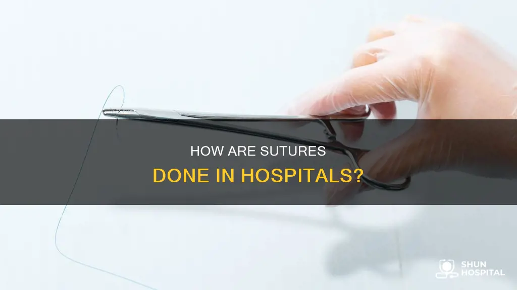 are sutures done by hand at hospital