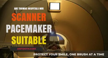 MRI Scanners: Safe for Pacemakers at Thomas Hospitals?