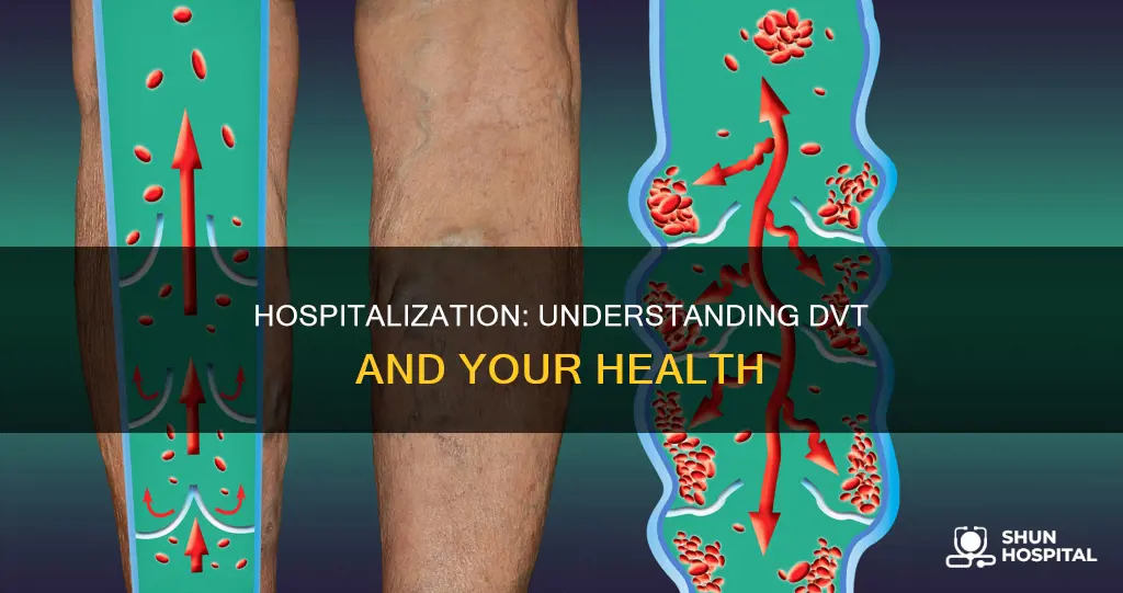 are you admitted to hospital for dvt