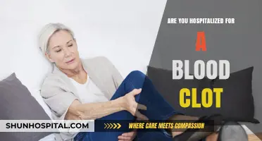 Blood Clots: When Hospitalization is Necessary