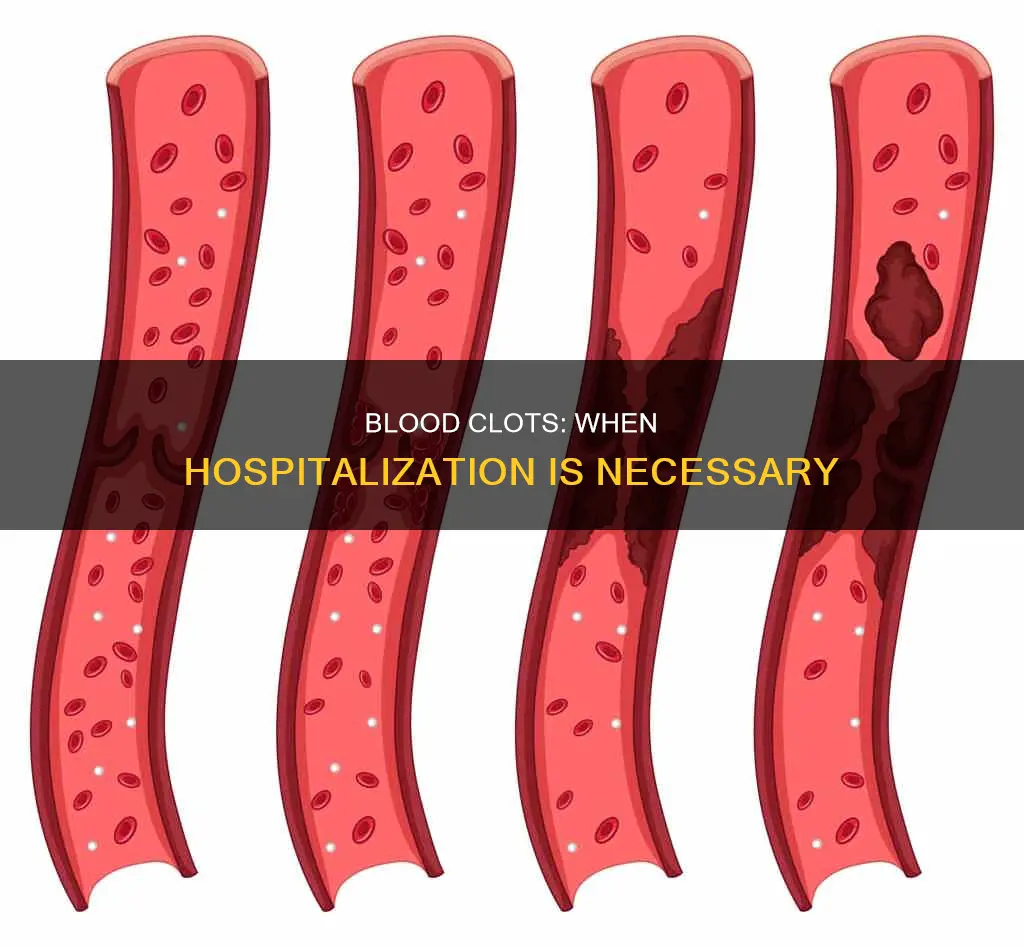 are you hospitalized for a blood clot