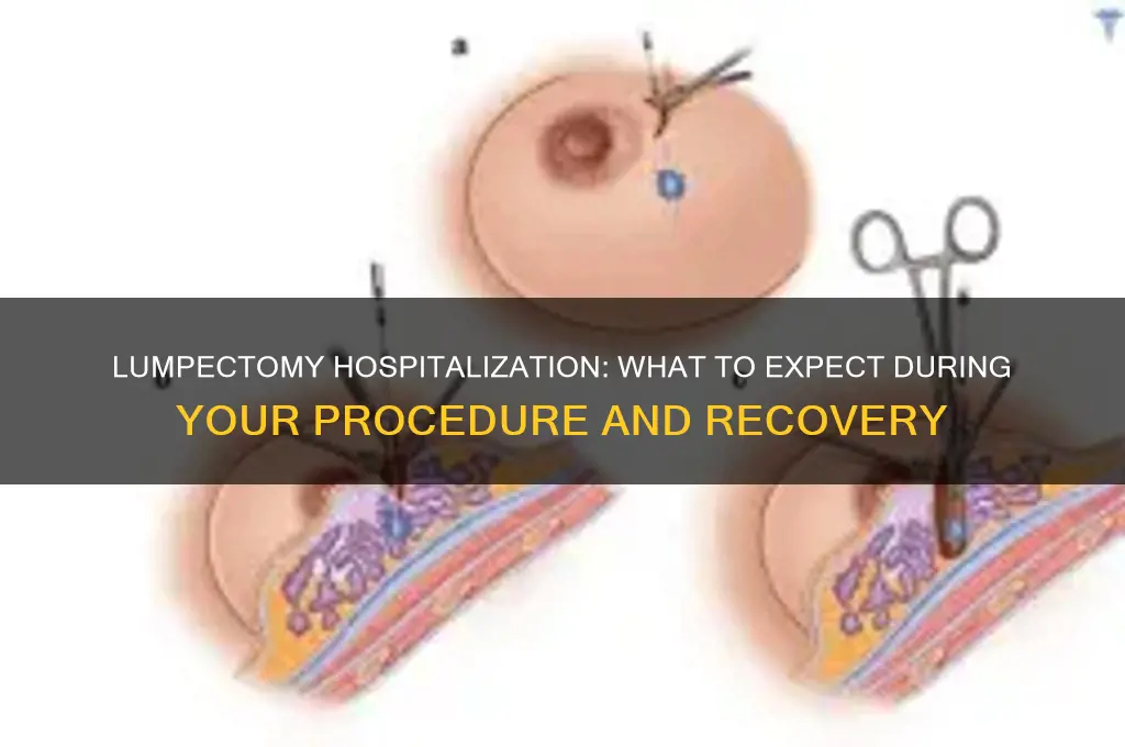are you hospitalized for lumpectomy