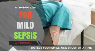 Understanding Mild Sepsis: When Does It Require Hospitalization?