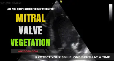 Mitral Valve Vegetation: Understanding the Six-Week Hospitalization Requirement