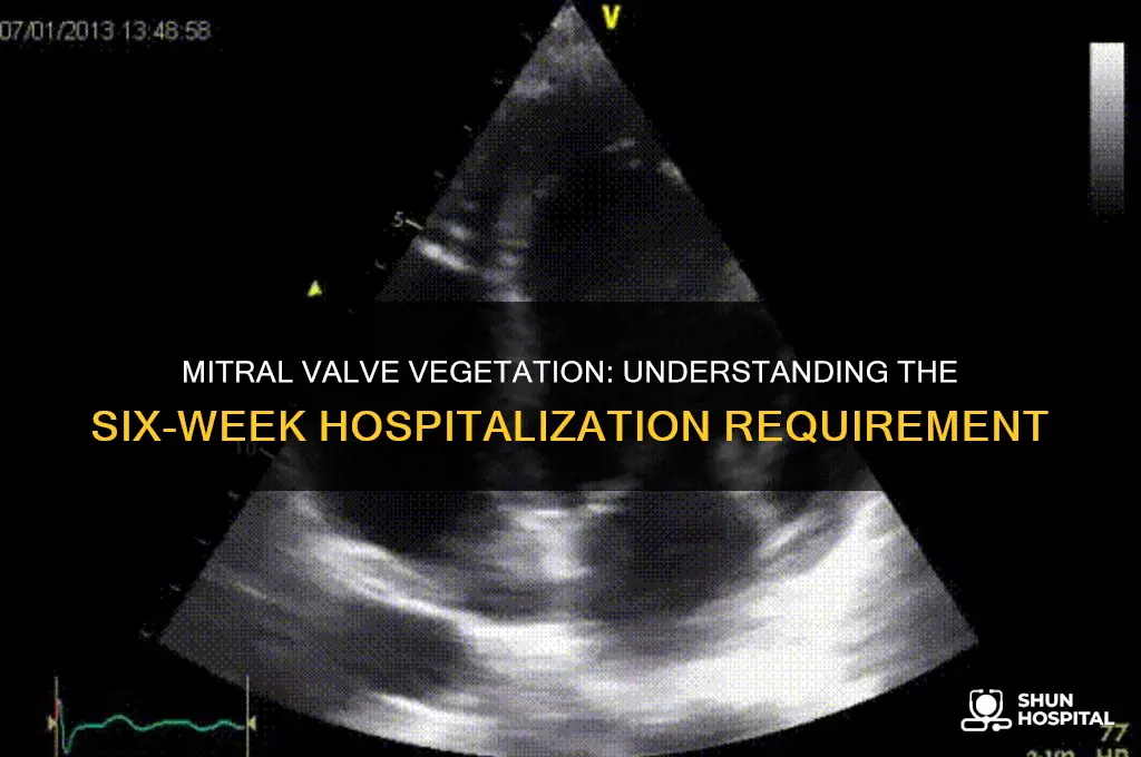 are you hospitalized for six weeks for mitral valve vegetation