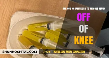 Knee Fluid Removal: Understanding Hospitalization for Knee Aspiration Procedures