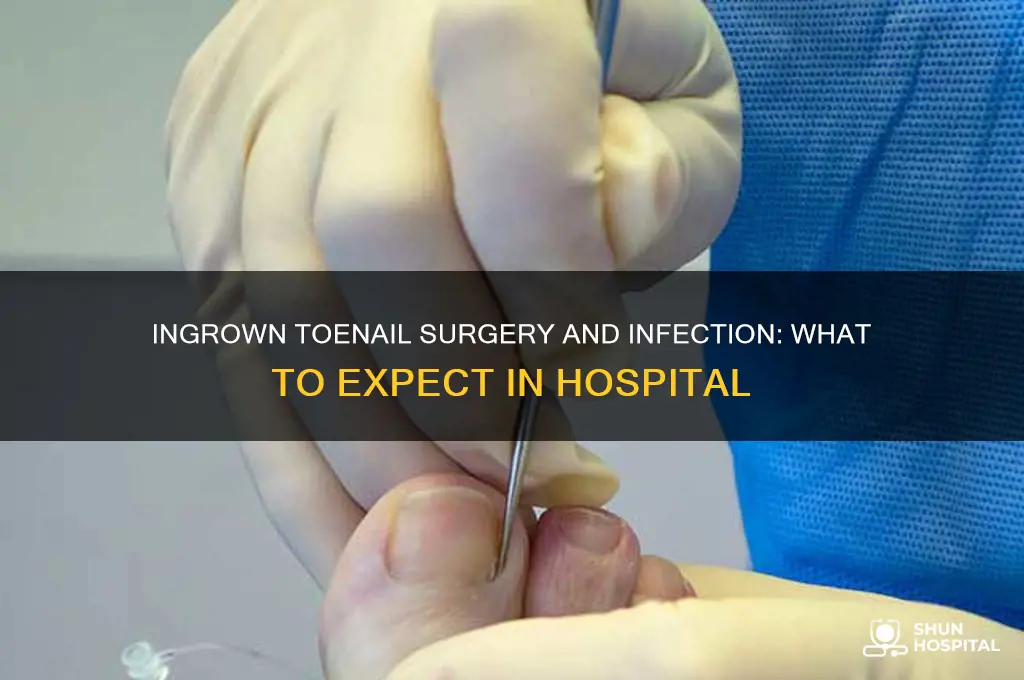 are you in hospital for ingrown toenail surgery and infection
