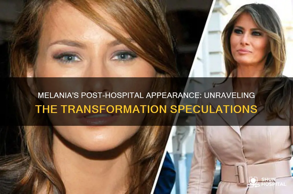 did melanias looks change after she was in the hospital