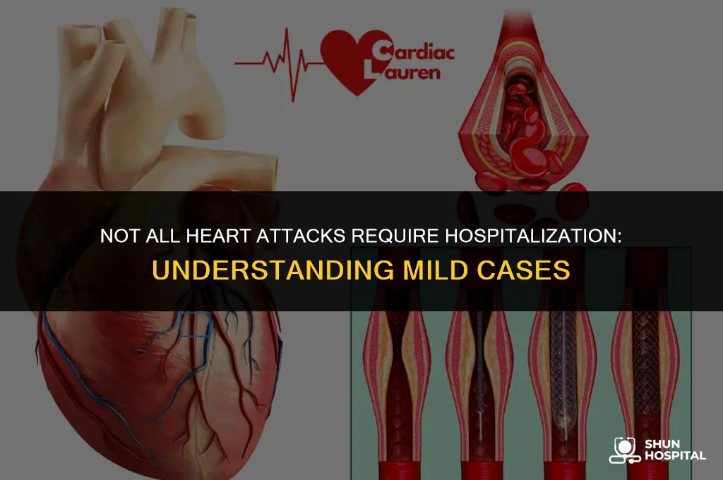 do all heart attacks require hospitalization