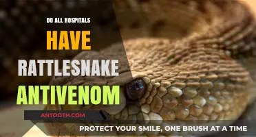 Do All Hospitals Stock Rattlesnake Antivenom? A Comprehensive Guide