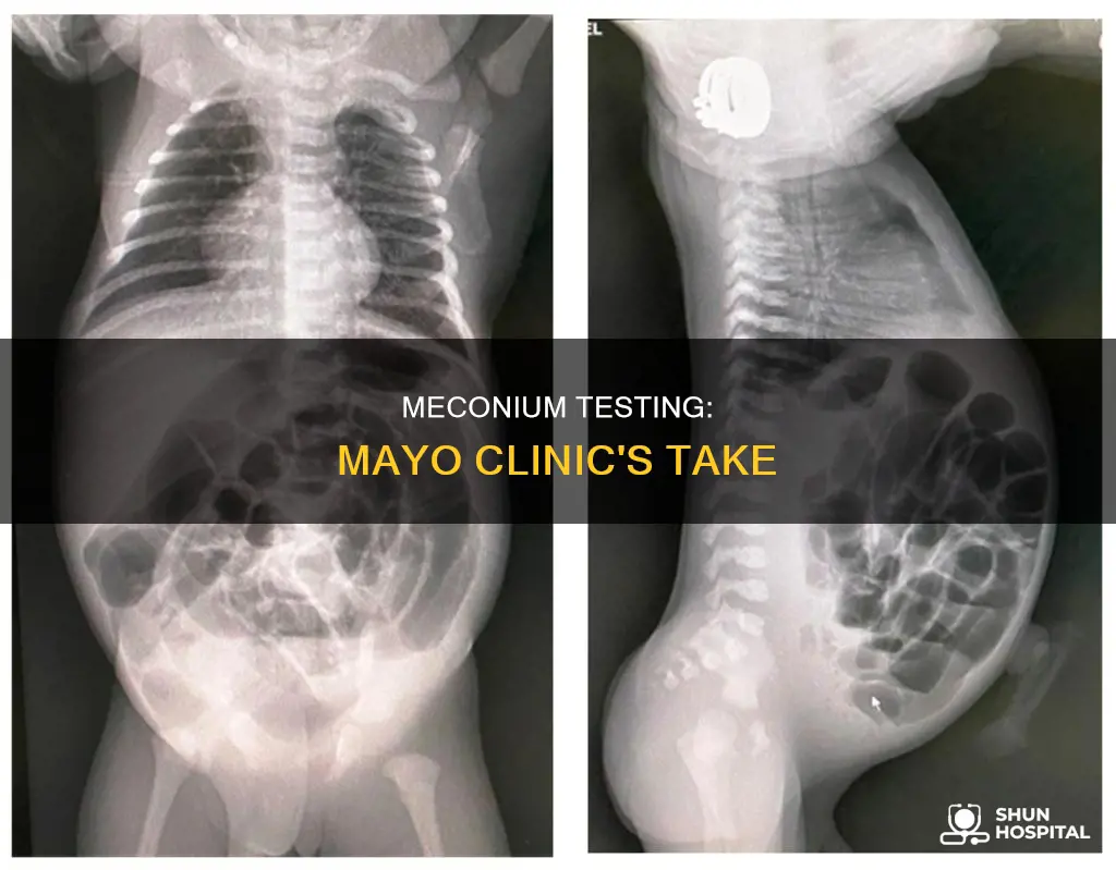 do all hospitals test meconium mayo clini