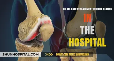 Knee Replacement Surgery: Hospital Stay Required or Outpatient Option?
