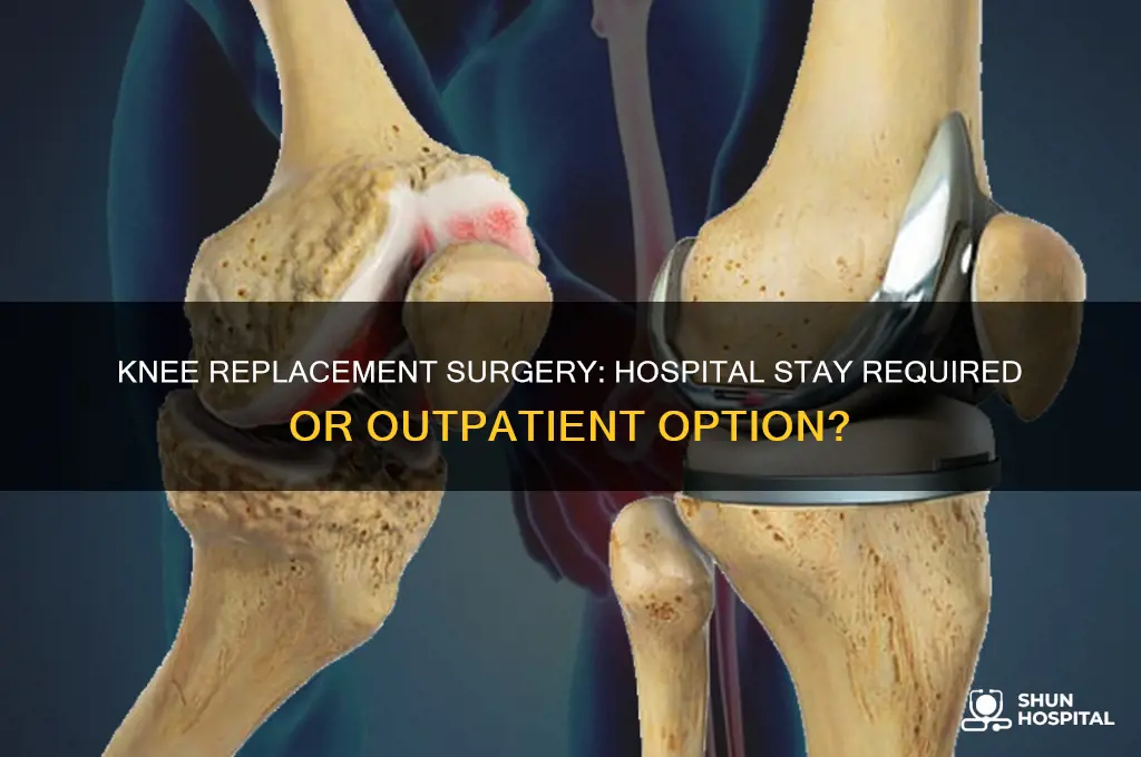 do all knee replacement require staying in the hospital