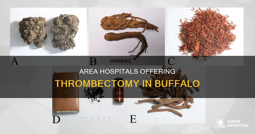 do any area hospitals offer thrombectomy buffalo