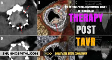 Short Anticoagulant Therapy Post-TAVR: Hospital Recommendations and Insights