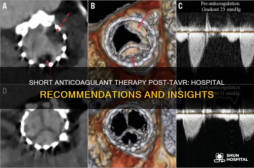 do any hospitals recommend short anticoagulant therapy post tavr