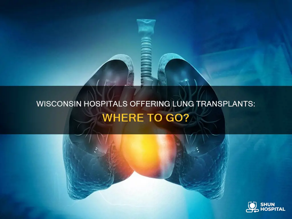 do any wisconsin hospitals preform lung transplants