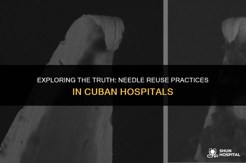 do cuba reuse needles in hospitals
