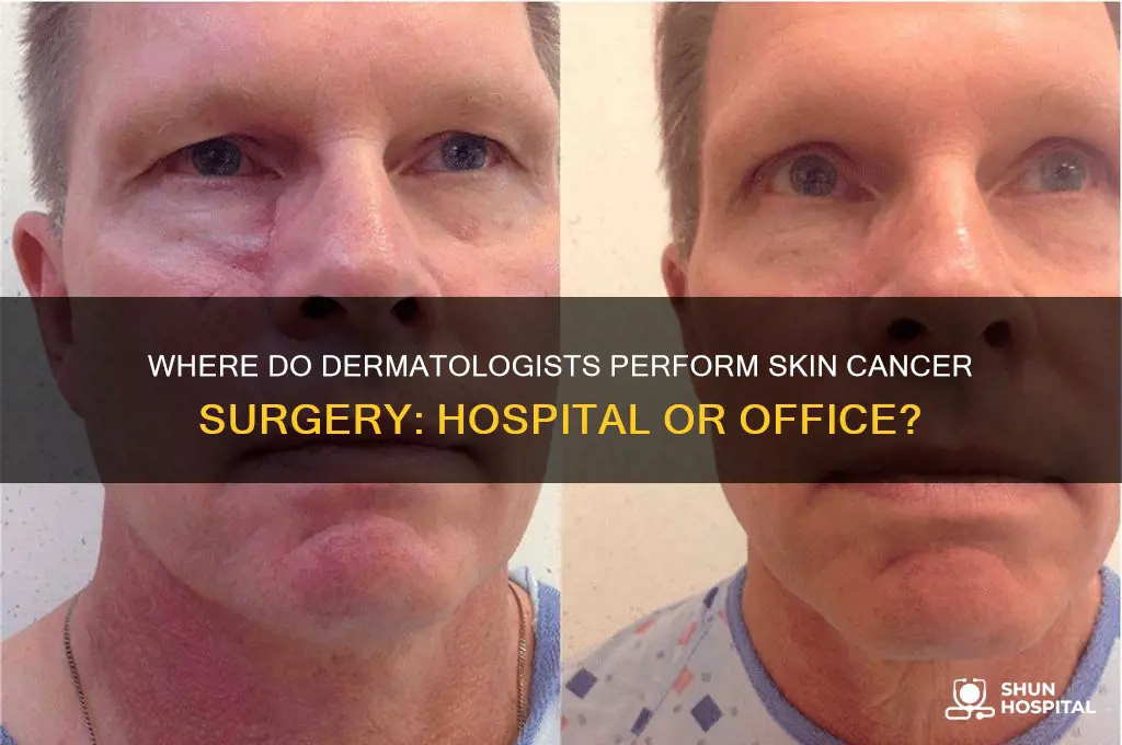 do dermatologist do cancer surgery in hospitals or their offices