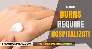 Facial Burns: When to Seek Hospitalization for Proper Treatment