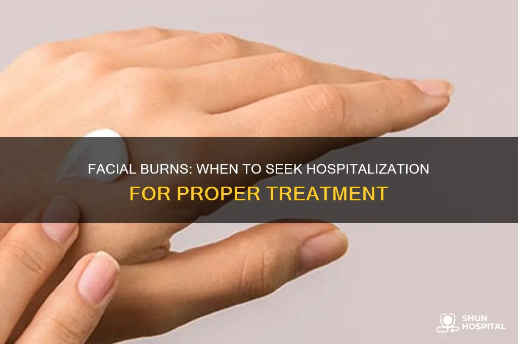 do facial burns require hospitalization