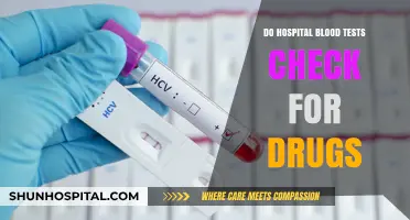 Blood Tests and Drug Detection: What Hospitals Check For