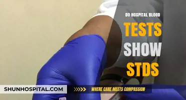 Unveiling the Truth: Do Hospital Blood Tests Detect STDs?