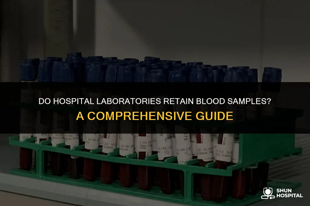 do hospital laboratory keep blood samples