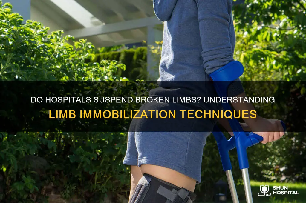 do hospital suspend broken limbs
