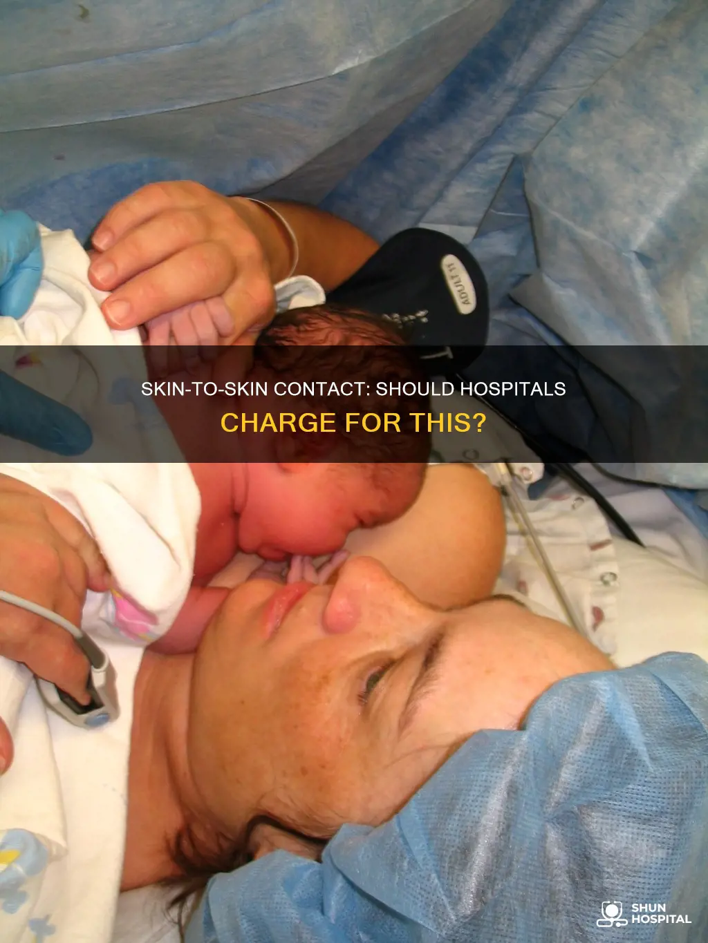 do hospitals charge for skin to skin