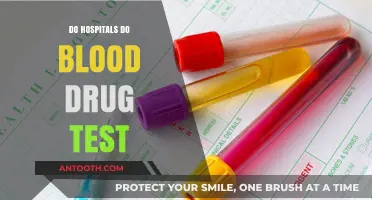Exploring Hospital Practices: Do They Conduct Blood Drug Tests?