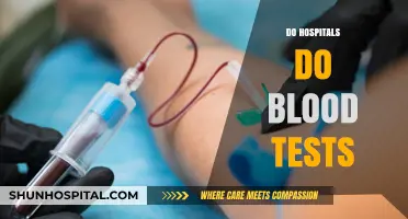 Do Hospitals Perform Blood Tests? Understanding Common Medical Procedures