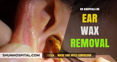 Do Hospitals Offer Ear Wax Removal Services?