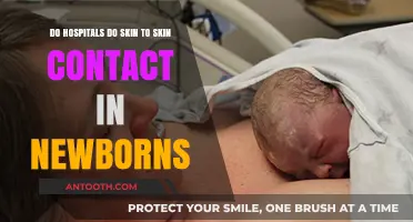 Skin-to-Skin Contact in Newborns: Hospital Practices and Benefits Explained
