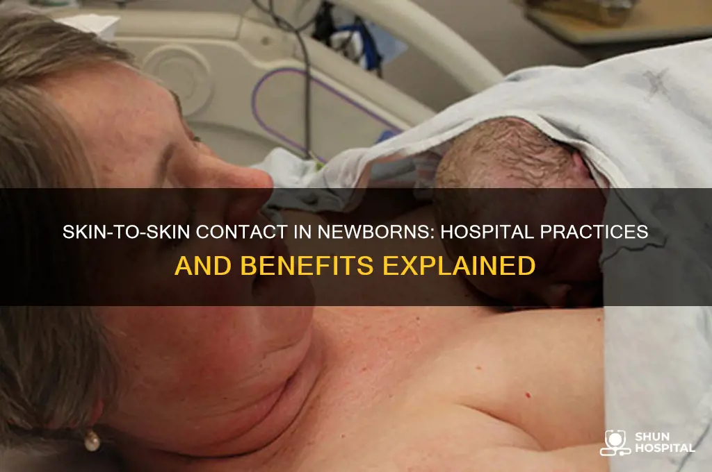 do hospitals do skin to skin contact in newborns