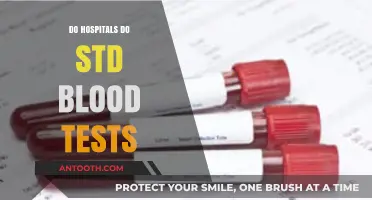Unveiling the Truth: Do Hospitals Conduct STD Blood Tests?