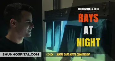 X-Rays: Are They Available in Hospitals After-Hours?