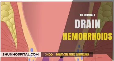 Do Hospitals Drain Hemorrhoids? Understanding Treatment Options and Procedures