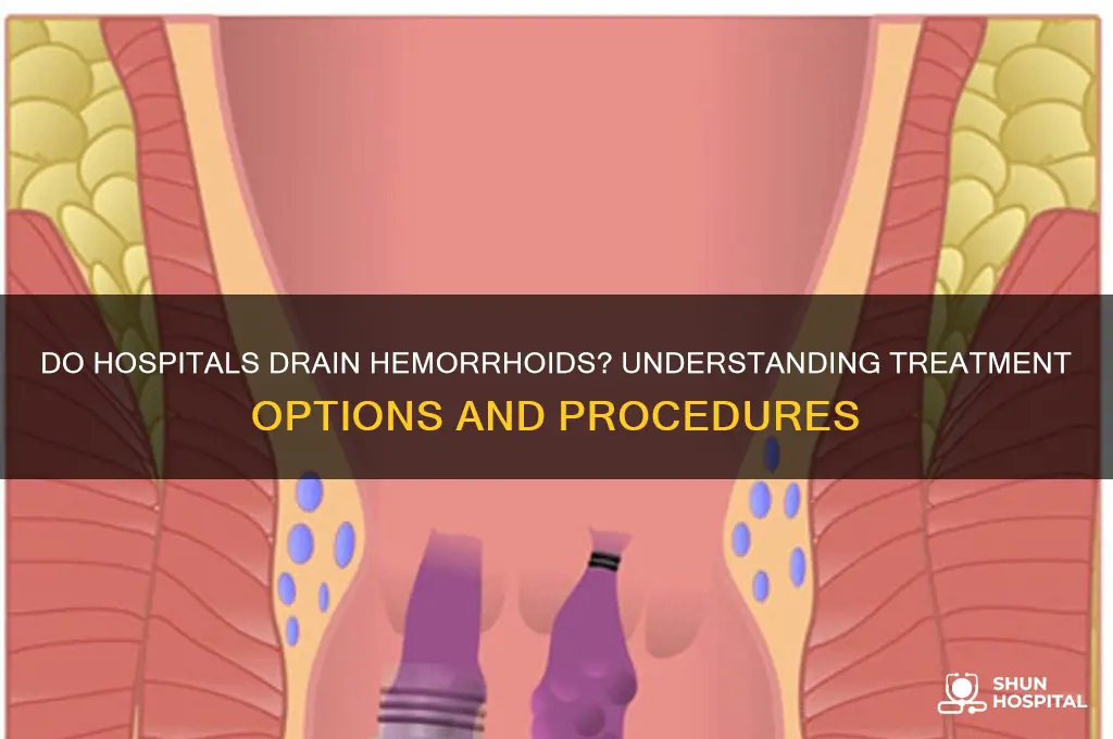do hospitals drain hemorrhoids
