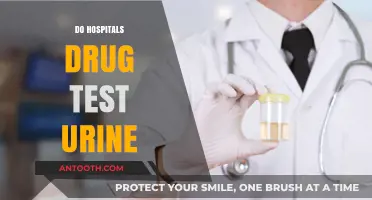 Do Hospitals Drug Test Urine? Understanding Common Medical Practices