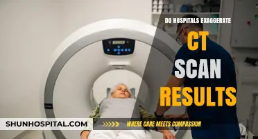 Unveiling the Truth: Do Hospitals Overstate CT Scan Findings?